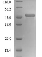 Human Tubulin beta-4A chain (TUBB4A) Recombinant Protein, N-His, aa 1–444, Yeast - BioCrest Sci
