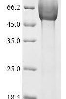 Giardia intestinalis Surface antigen CRP170, partial Recombinant Protein - BioCrest Sci