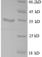 Escherichia coli 30S ribosomal protein S21 (rpsU) Recombinant Protein - BioCrest Sci