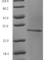 Human Glutaminase kidney isoform, mitochondrial (GLS), partial Recombinant Protein, N-GST, aa 616–669 - BioCrest Sci