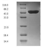 Mouse Ubiquitin-protein ligase E3A (Ube3a), partial Recombinant Protein, C-Flag-Myc - BioCrest Sci