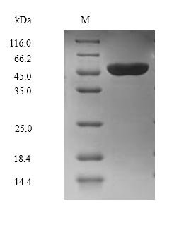 Mouse Ubiquitin-protein ligase E3A (Ube3a), partial Recombinant Protein, C-Flag-Myc, Mus musculus (Mouse), Mammalian cell, C-terminal Flag-Myc-tagged, 40.9 kDa, purity >≥ 90% as determined by SDS-PAGE.