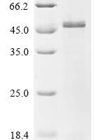 Human E3 ubiquitin-protein ligase RNF126 (RNF126) Recombinant Protein - BioCrest Sci