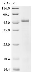 Human E3 ubiquitin-protein ligase RNF126 (RNF126) Recombinant Protein, Homo sapiens (Human), E.coli, C-terminal 6xHis-tagged, 40.6 kDa, purity >≥ 85% as determined by SDS-PAGE.