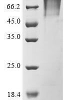 Human SARS coronavirus Spike glycoprotein (S), partial Recombinant Protein, N-His-SUMOstar - BioCrest Sci