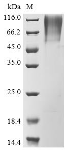 Human SARS coronavirus Spike glycoprotein (S), partial Recombinant Protein, N-His-SUMOstar, Human SARS coronavirus (SARS-CoV) (Severe acute respiratory syndrome coronavirus), Yeast, N-terminal 6xHis-sumostar-tagged, 39.0 kDa, purity >≥ 85% as determined by SDS-PAGE.