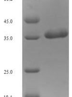 Human xcitatory amino acid transporter 3 (SLC1A1), partial Recombinant Protein - BioCrest Sci