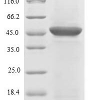 Human Tumor necrosis factor receptor superfamily member 1B (TNFRSF1B), partial Recombinant Protein, N-GST - BioCrest Sci