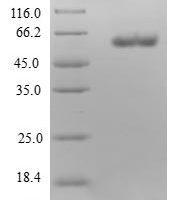 Human Electron transfer flavoprotein subunit alpha, mitochondrial (ETFA) Recombinant Protein - BioCrest Sci