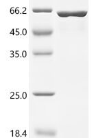 Human Vimentin (VIM) Recombinant Protein, C-His, aa 2–466, E.coli - BioCrest Sci