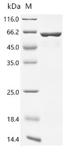 Human Vimentin (VIM) Recombinant Protein, C-His, aa 2–466, E.coli, Homo sapiens (Human), E.coli, C-terminal 6xHis-tagged, 60.4 kDa, purity >≥ 90% as determined by SDS-PAGE.
