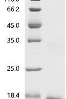Human Ly-6/neurotoxin-like protein 1 (LYNX1) Recombinant Protein, C-His, Mature - BioCrest Sci