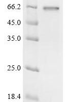 Orientia tsutsugamushi 56 KDA type-specific antigen Recombinant Protein - BioCrest Sci