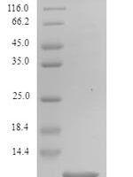 Phoneutria nigriventer Delta-ctenitoxin-Pn1a (PNTx4) Recombinant Protein - BioCrest Sci