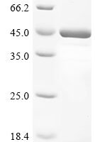 Human herpesvirus 1 Major capsid protein (MCP), partial Recombinant Protein - BioCrest Sci