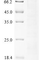 Human Protein kinase C eta type (PRKCH) Recombinant Protein - BioCrest Sci