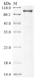 Human Protein kinase C eta type (PRKCH) Recombinant Protein, Homo sapiens (Human), E.coli, N-terminal 6xHis-tagged, 81.9 kDa, purity >≥ 85% as determined by SDS-PAGE.