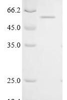 Human Cysteine dioxygenase type 1 (CDO1) Recombinant Protein, C-GST - BioCrest Sci