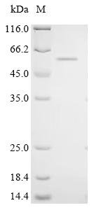 Human Cysteine dioxygenase type 1 (CDO1) Recombinant Protein, C-GST, Homo sapiens (Human), E.coli, C-terminal GST-tagged, 54.5 kDa, purity >≥ 85% as determined by SDS-PAGE.