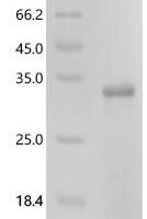Human Rho-related GTP-binding protein RhoC (RHOC) Recombinant Protein - BioCrest Sci