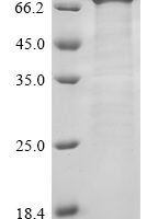 Escherichia coli Chemotaxis protein CheA (cheA) Recombinant Protein - BioCrest Sci