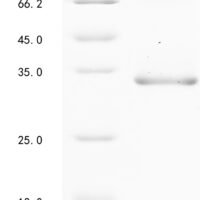Mouse A disintegrin and metalloproteinase with thrombospondin motifs 13 (Adamts13), partial Recombinant Protein, N-His - BioCrest Sci