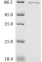 Human Early activation antigen CD69 (Cd69), partial,Biotinylated Recombinant Protein - BioCrest Sci