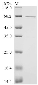Human Early activation antigen CD69 (Cd69), partial,Biotinylated Recombinant Protein, Homo sapiens (Human), E.coli, N-terminal MBP-tagged and C-terminal 6xHis-Avi-tagged, 63.7 kDa, purity >≥ 90% as determined by SDS-PAGE.