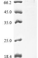 Human Protein phosphatase 1 regulatory subunit 15A (PPP1R15A), partial Recombinant Protein, N-His, aa 40–674, E.coli - BioCrest Sci