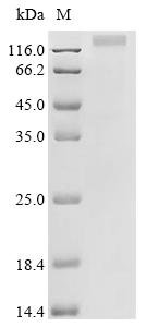 Human Protein NDNF (NDNF) Recombinant Protein, Homo sapiens (Human), Homo sapiens (Human), C-terminal 10xHis-tagged, 64.2 kDa, purity >≥ 85% as determined by SDS-PAGE.