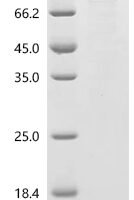 Mumps virus Fusion glycoprotein F0 (F), partial, Biotinylated Recombinant Protein - BioCrest Sci