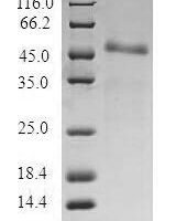 Human Centromere protein R (ITGB3BP) Recombinant Protein - BioCrest Sci