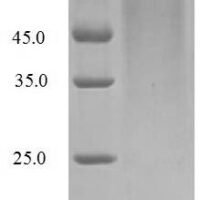 Influenza B virus Non-structural protein 1 (NS) Recombinant Protein, N-His, aa 1–281, strain B/Singapore/222/1979 - BioCrest Sci