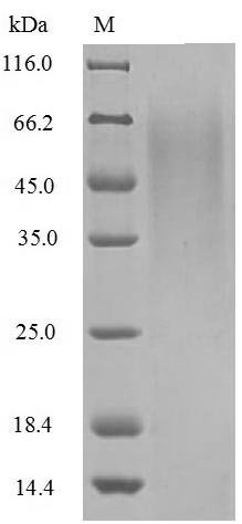 Influenza B virus Non-structural protein 1 (NS) Recombinant Protein, N-His, aa 1–281, strain B/Singapore/222/1979, Influenza B virus (strain B/Singapore/222/1979), Yeast, N-terminal 6xHis-tagged, 34.2 kDa, purity >≥ 85% as determined by SDS-PAGE.