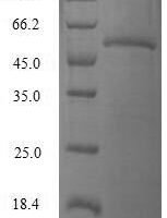 Human Ras-related protein Rab-4A (RAB4A) Recombinant Protein - BioCrest Sci