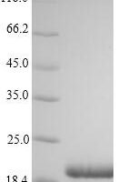 Hepatitis B virus genotype C subtype adr Large envelope protein (S), partial Recombinant Protein - BioCrest Sci
