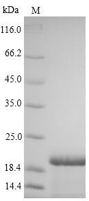 Hepatitis B virus genotype C subtype adr Large envelope protein (S), partial Recombinant Protein, Hepatitis B virus genotype C subtype adr (isolate Japan/Nishioka/1983) (HBV-C), Yeast, N-terminal 6xHis-tagged, 20.9 kDa, purity >≥ 90% as determined by SDS-PAGE.