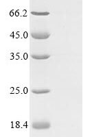 Human Mucin-21 (MUC21), partial Recombinant Protein - BioCrest Sci