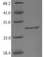 Bovine Beta-1,4-galactosyltransferase 1 (B4GALT1), partial Recombinant Protein, N-GST, aa 1–24, Yeast - BioCrest Sci