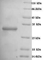Human Carbonic anhydrase 1 (CA1) Recombinant Protein - BioCrest Sci