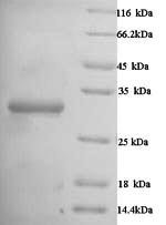 Human Carbonic anhydrase 1 (CA1) Recombinant Protein, Homo sapiens (Human), Yeast, N-terminal 6xHis-tagged, 30.7 kDa, purity >≥ 90% as determined by SDS-PAGE.