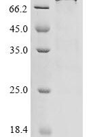 Human Antithrombin-III (SERPINC1) Recombinant Protein, C-hFc1 - BioCrest Sci