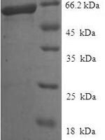 Human Endonuclease 8-like 1 (NEIL1) Recombinant Protein - BioCrest Sci