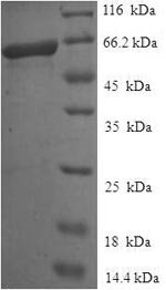 Human Endonuclease 8-like 1 (NEIL1) Recombinant Protein, Homo sapiens (Human), E.coli, N-terminal 6xHis-SUMO-tagged, 59.6 kDa, purity >≥ 90% as determined by SDS-PAGE.