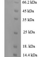Human Vascular endothelial growth factor receptor 2 (KDR), partial Recombinant Protein - BioCrest Sci