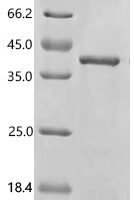 Human MHC class I polypeptide-related sequence A (MICA), partial Recombinant Protein, N-His, aa 24–307, E.coli - BioCrest Sci