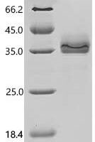 Human Epithelial cell adhesion molecule (EPCAM), partial, Biotinylated Recombinant Protein - BioCrest Sci