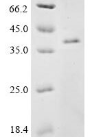 Mouse CCN family member 1 (Ccn1) Recombinant Protein, N-10His, aa 25–379, Baculovirus - BioCrest Sci