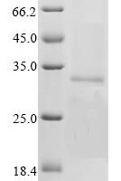 Bovine coronavirus Non-structural protein 2a (2a) Recombinant Protein, C-His - BioCrest Sci