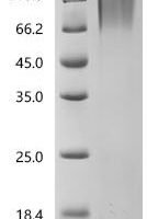 Pig Scavenger receptor cysteine-rich type 1 protein M130 (CD163), partial Recombinant Protein, C-10His - BioCrest Sci